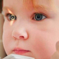 Teste do olhinhoExame simples, rápido e indolor, que consiste na identificação de um reflexo vermelho, que aparece quando um feixe de luz ilumina o olho do bebê.